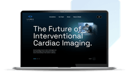 Screenshot of the Luma Vision website displayed in a laptop