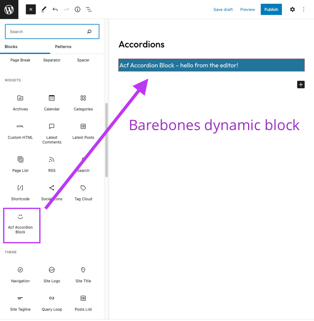WordPress editor with newly created accordion block inserted
